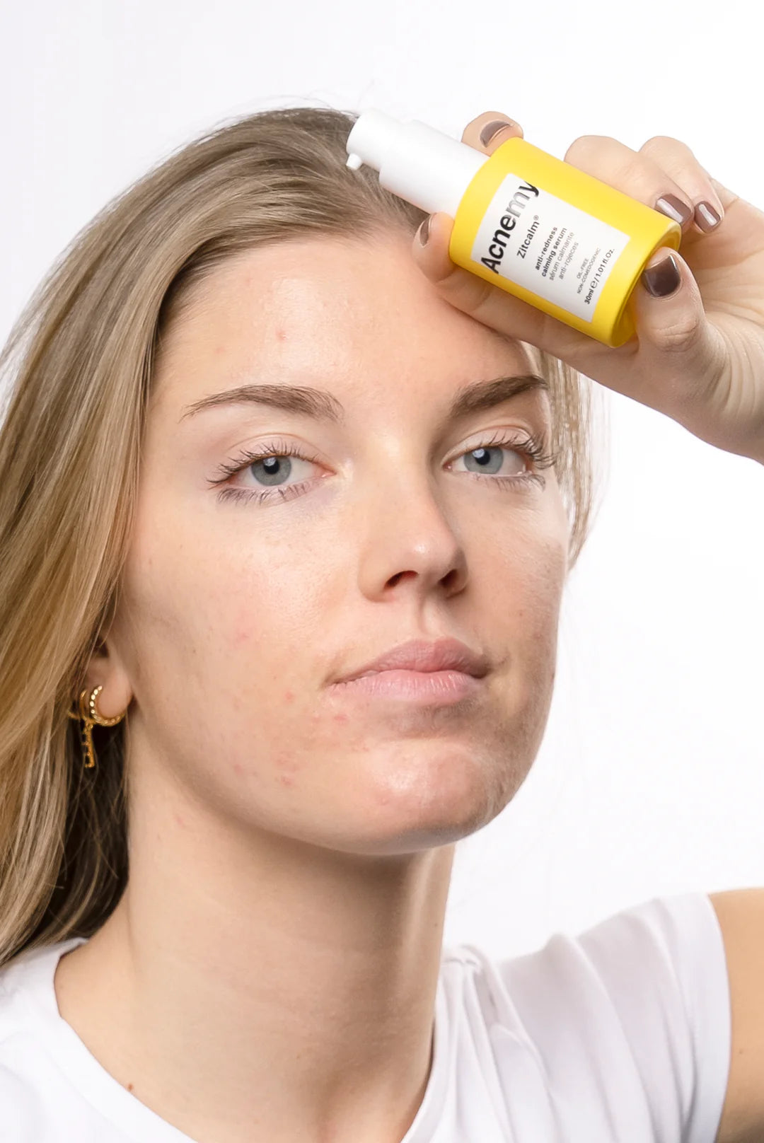 Acnemy ZITCALM® Serum